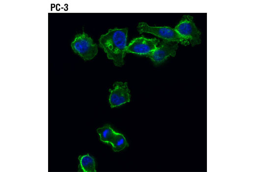 Hippo Pathway: Upstream Signaling Antibody Sampler Kit