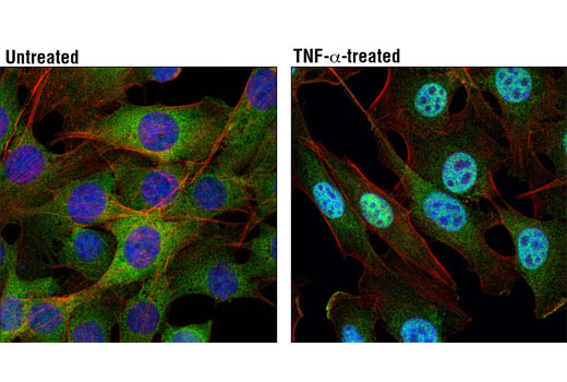NF-kappaB Pathway Antibody Sampler Kit II