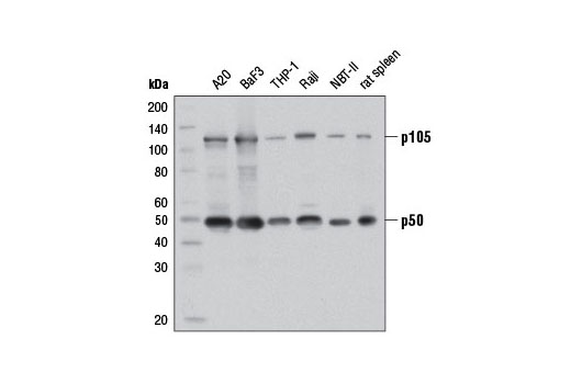 NF-kappaB1 p105/p50 (D4P4D) Rabbit mAb