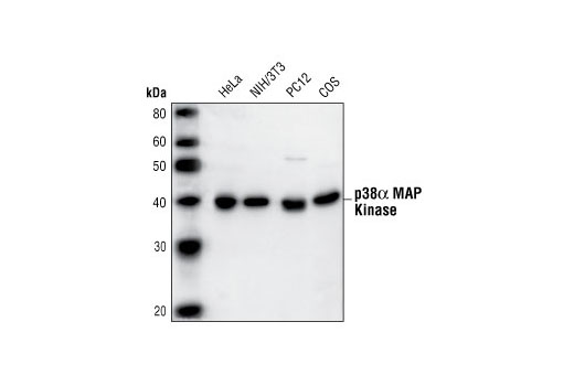 p38 MAPK Isoform Activation Antibody Sampler Kit