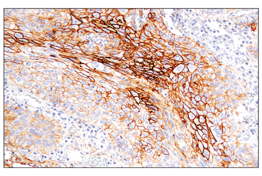 Exosomal Marker Antibody Sampler Kit