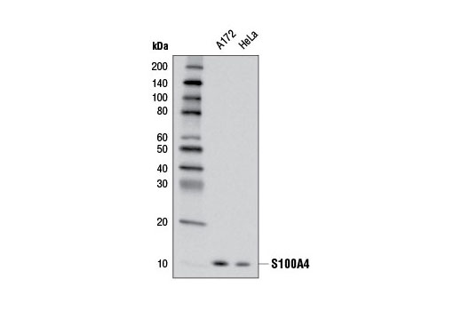 Cancer Associated Fibroblast Marker Antibody Sampler Kit