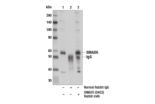 SMAD 1/5/9 Antibody Sampler Kit