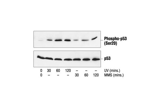 p53 Antibody Sampler Kit