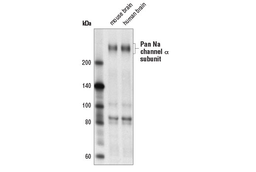 Pan Na Channel alpha Subunit (D2I9C) Rabbit mAb