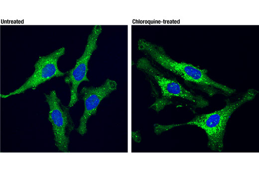 Human Reactive Cell Death and Autophagy Antibody Sampler Kit