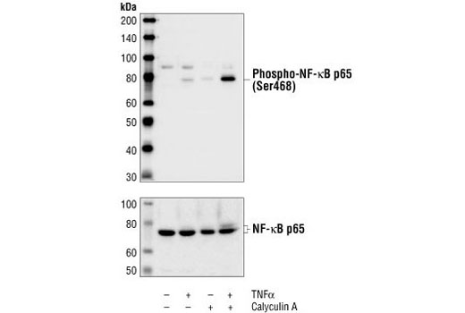 Phospho-NF-kappaB p65 (Ser468) Antibody