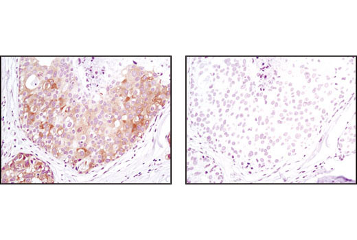 mTOR Regulation Antibody Sampler Kit