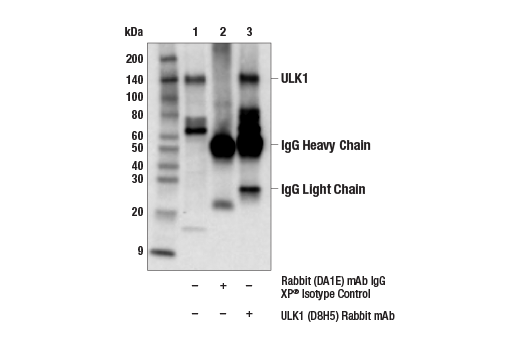 ULK1 Antibody Sampler Kit