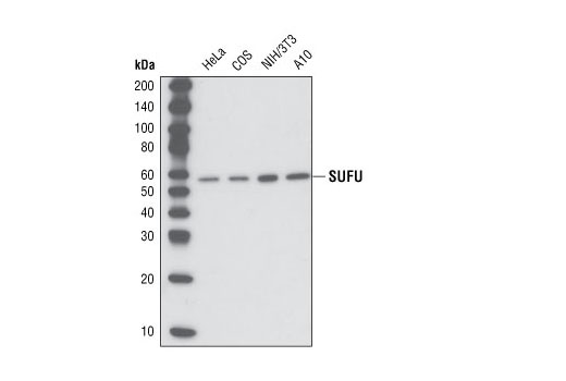 Hedgehog Signaling Antibody Sampler Kit