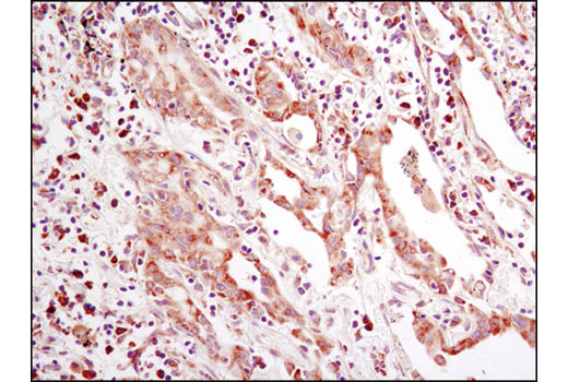 ER Stress-induced Autophagy Antibody Sampler Kit