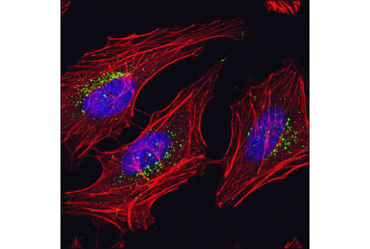 mTOR Regulation Antibody Sampler Kit