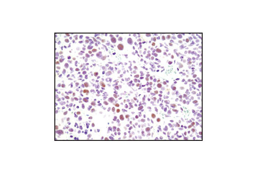 CDK Antibody Sampler Kit