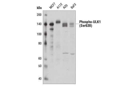 Phospho-ULK1 (Ser638) (D8K9O) Rabbit mAb