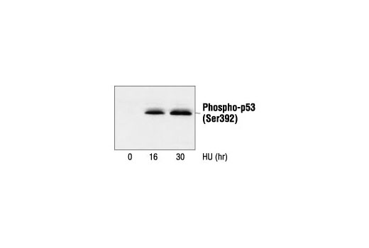p53 Antibody Sampler Kit