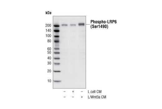 Wnt Signaling Antibody Sampler Kit