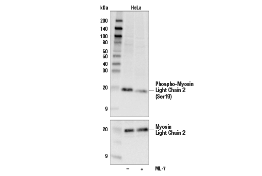 Phospho-Myosin Light Chain 2 (Ser19) Mouse mAb