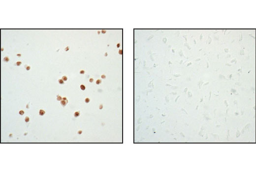 p53 Antibody Sampler Kit