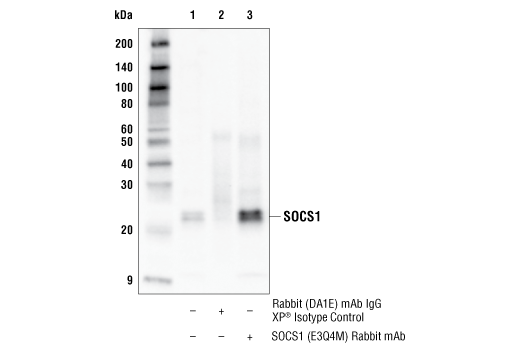 Jak/Stat Pathway Inhibitors Antibody Sampler Kit