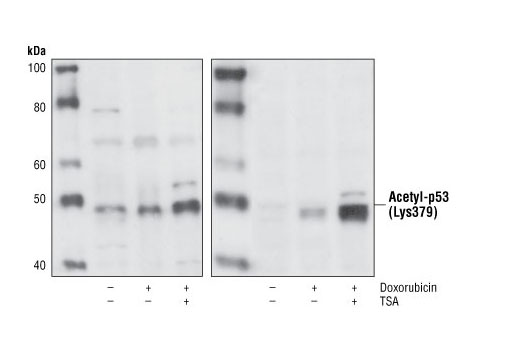 p53 Antibody Sampler Kit