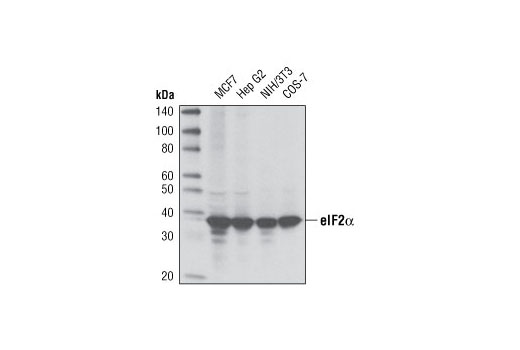ER Stress-induced Autophagy Antibody Sampler Kit