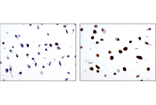 Phospho-Erk1/2 Pathway Antibody Sampler Kit