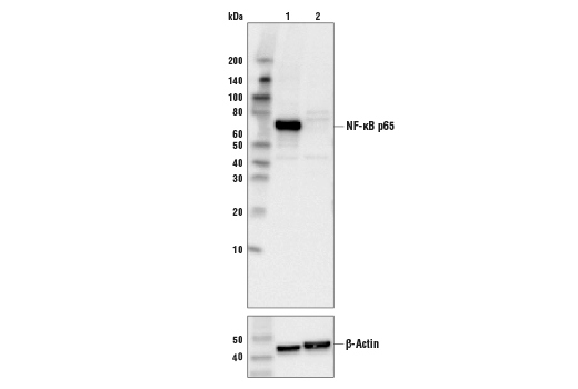 NF-kappaB p65 (L8F6) Mouse mAb