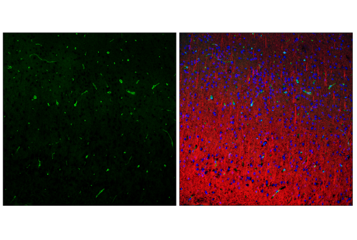 Cancer Associated Fibroblast Marker Antibody Sampler Kit