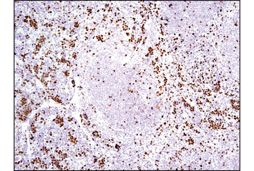 Ki-67 (D3B5) Rabbit mAb (IHC Formulated)