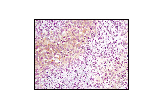 mTOR Regulation Antibody Sampler Kit