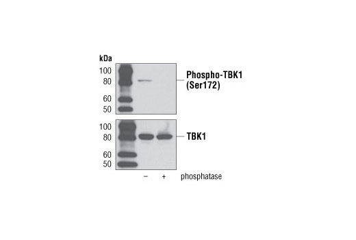 Phospho-TBK1/NAK (Ser172) (D52C2) XP ®  Rabbit mAb