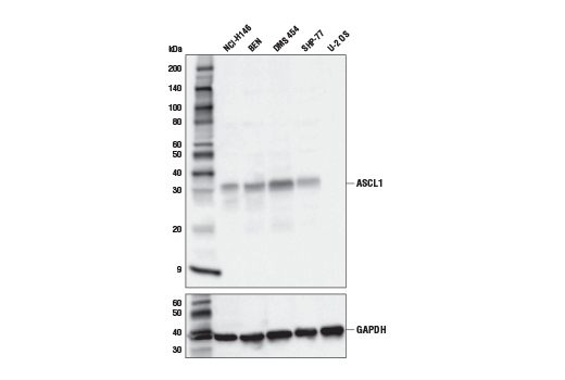 ASCL1 (E7N9C) Rabbit mAb