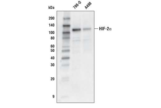 Hypoxia Pathway Antibody Sampler Kit