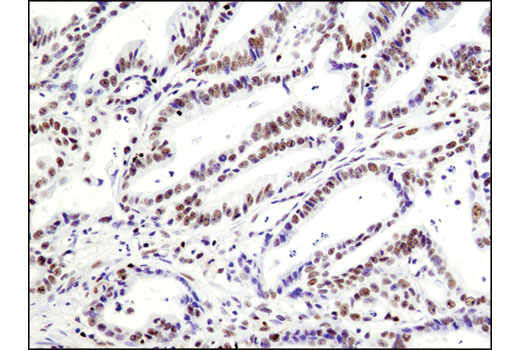 Notch Receptor Interaction Antibody Sampler Kit