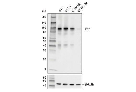 Cancer Associated Fibroblast Marker Antibody Sampler Kit