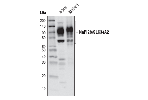 NaPi2b/SLC34A2 (D3V3I) Rabbit mAb