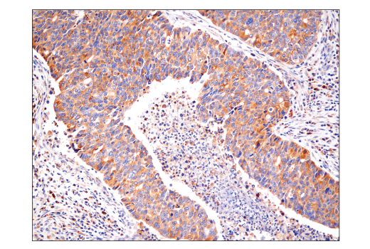 NF-kappaB Family Member Antibody Sampler Kit