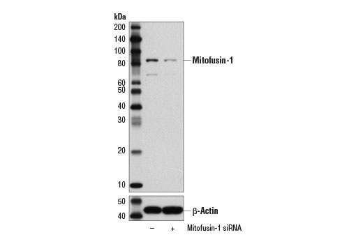 Mitochondrial Dynamics Antibody Sampler Kit II