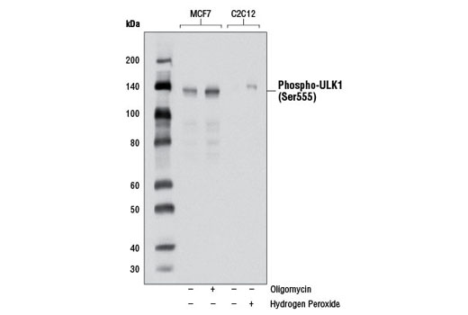 ULK1 Antibody Sampler Kit