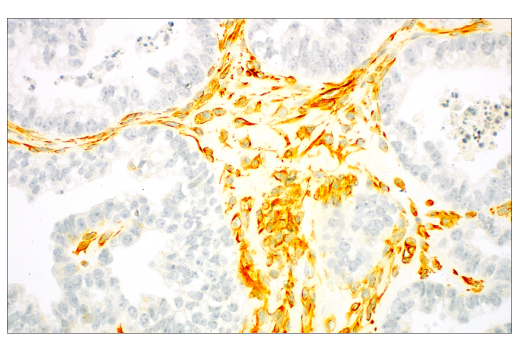 SignalStain ®  Radiant Yellow Peroxidase Substrate Kit