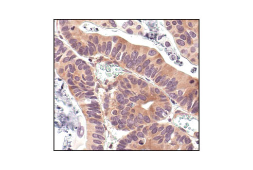 NF-kappaB Pathway Antibody Sampler Kit