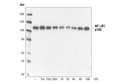 NF-kappaB Family Member Antibody Sampler Kit