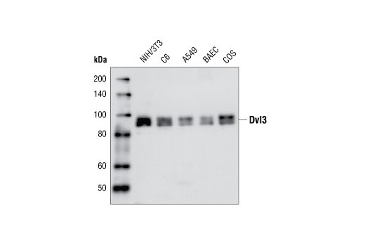 Wnt Signaling Antibody Sampler Kit