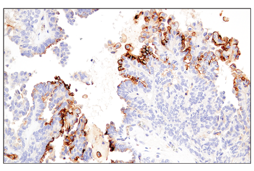 Exosomal Marker Antibody Sampler Kit