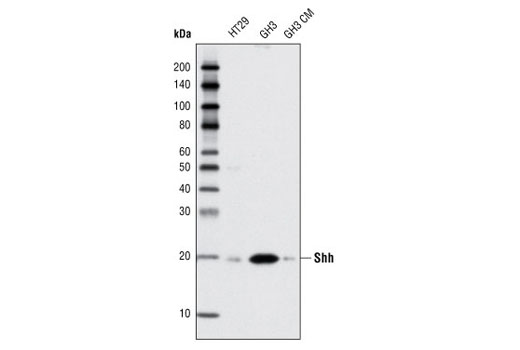 Hedgehog Signaling Antibody Sampler Kit