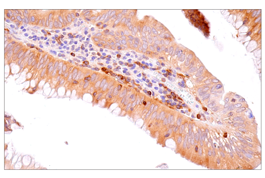 NF-kappaB Family Member Antibody Sampler Kit