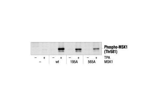 Phospho-Erk1/2 Pathway Antibody Sampler Kit