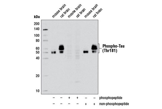 Phospho-Tau (Thr181) (D9F4G) Rabbit mAb