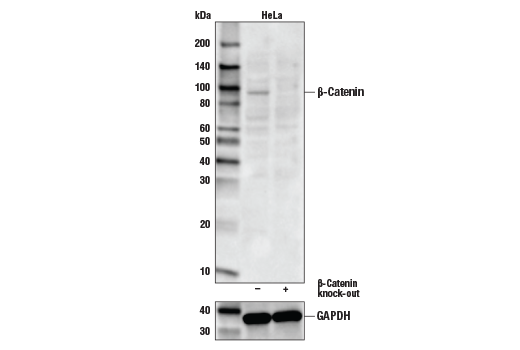 Non-phospho (Active) beta-Catenin (Ser33/37/Thr41) (D13A1) Rabbit mAb