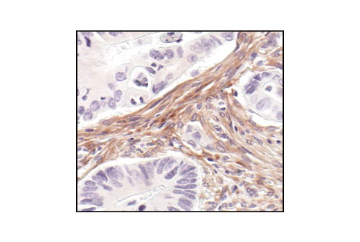 Cancer Associated Fibroblast Marker Antibody Sampler Kit